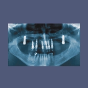 4 Radiografias (raio-x)