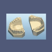 3 Modelos de gesso